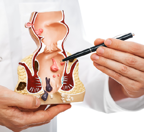 Dr. Sangeeta Panigrahi – Female Piles Doctor Andheri East