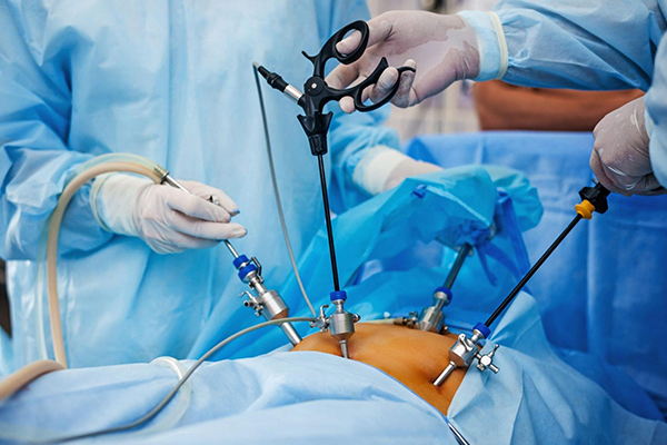 Laparoscopic Surgery