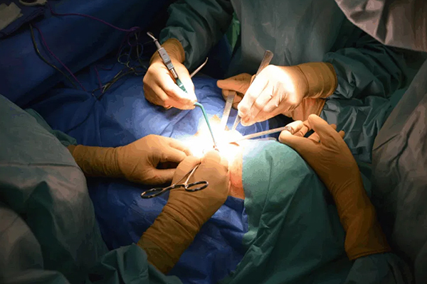 Hernia Surgery
