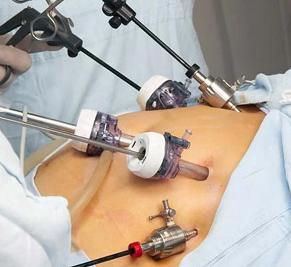 Dr. Sangeeta Panigrahi – Minimally Invasive Surgery Andheri East
