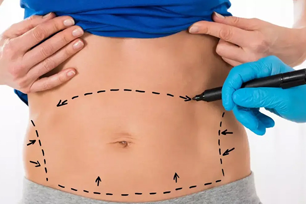 Abdominal Reconstruction
