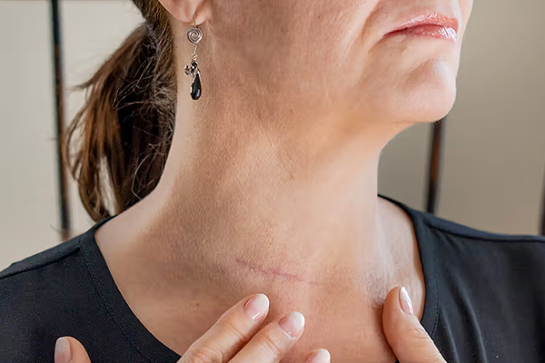 Thyroid Cancer Surgery